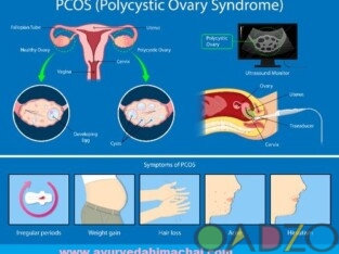 AROGYAM PURE HERBS KIT FOR PCOS / PCOD