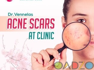 Best Skin Care Clinic near Medipally | Best Skin S